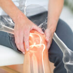 Calgary Hip and Knee Clinic