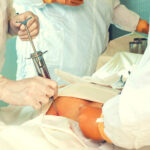 Stem Cell