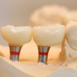 DentPrime
