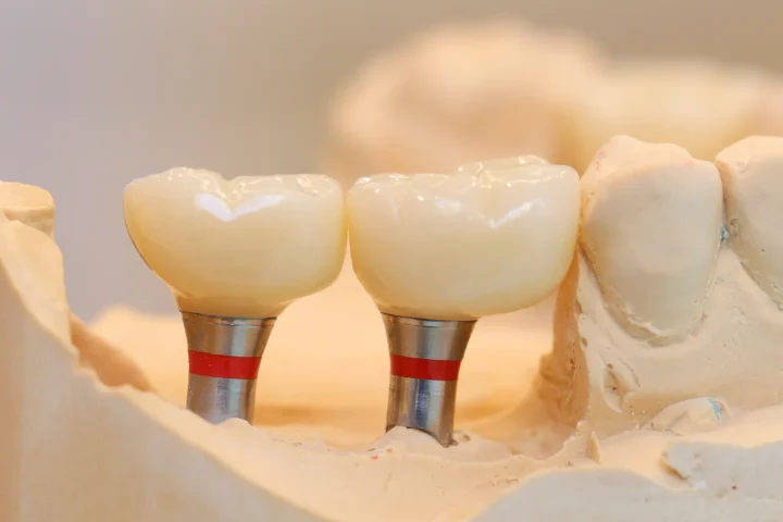 DentPrime