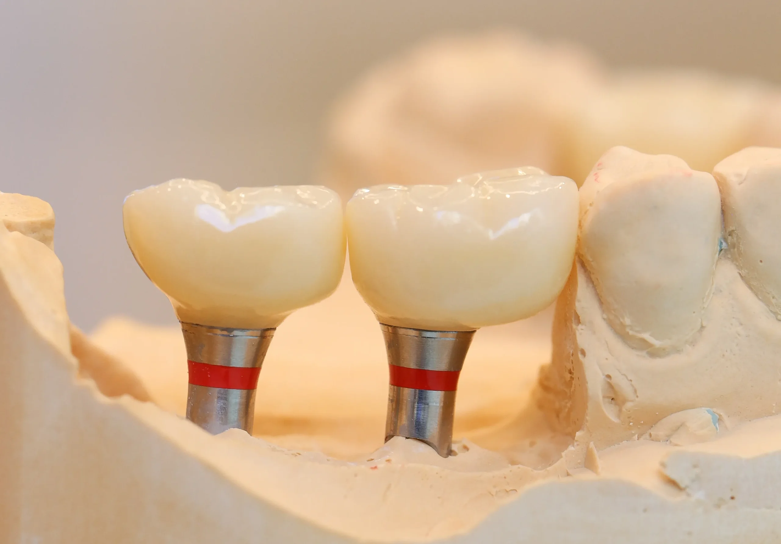 DentPrime